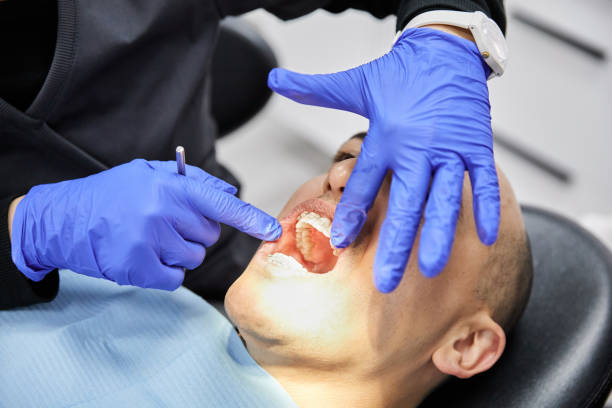 Best Emergency Root Canal Treatment in Greenfield, MO