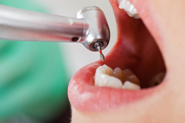 Best Emergency Cosmetic Dentistry in Greenfield, MO